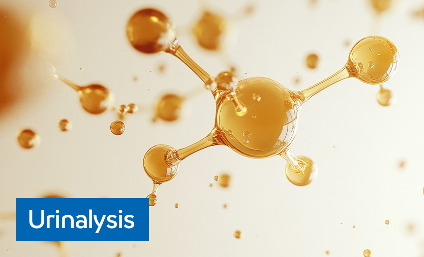 urinalysis image
