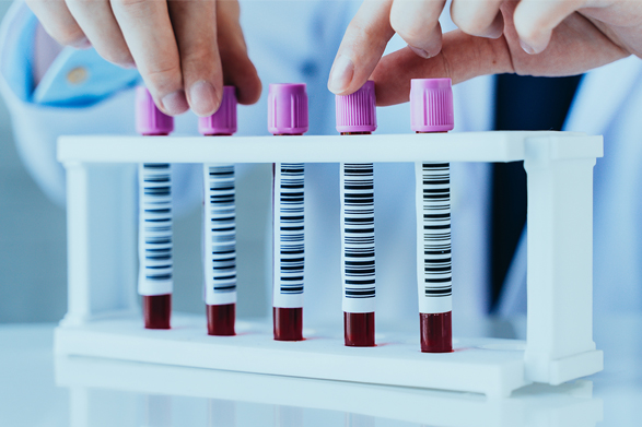 Muestras de sangre en tubos con tapa color lavanda