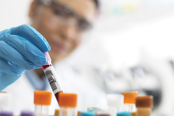 Técnico médico con muestra de sangre en tubo de muestras de sangre color lavanda
