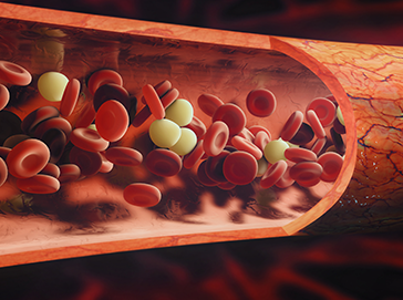 hematology webinar