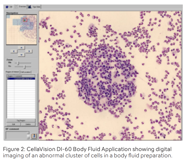 Automated Body Fluid Analysis for Increased Efficiency - Image 4