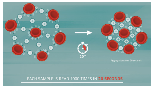 Erythrocyte Sedimentation Rate- Image 1