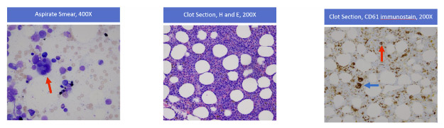 Flow Cytometric