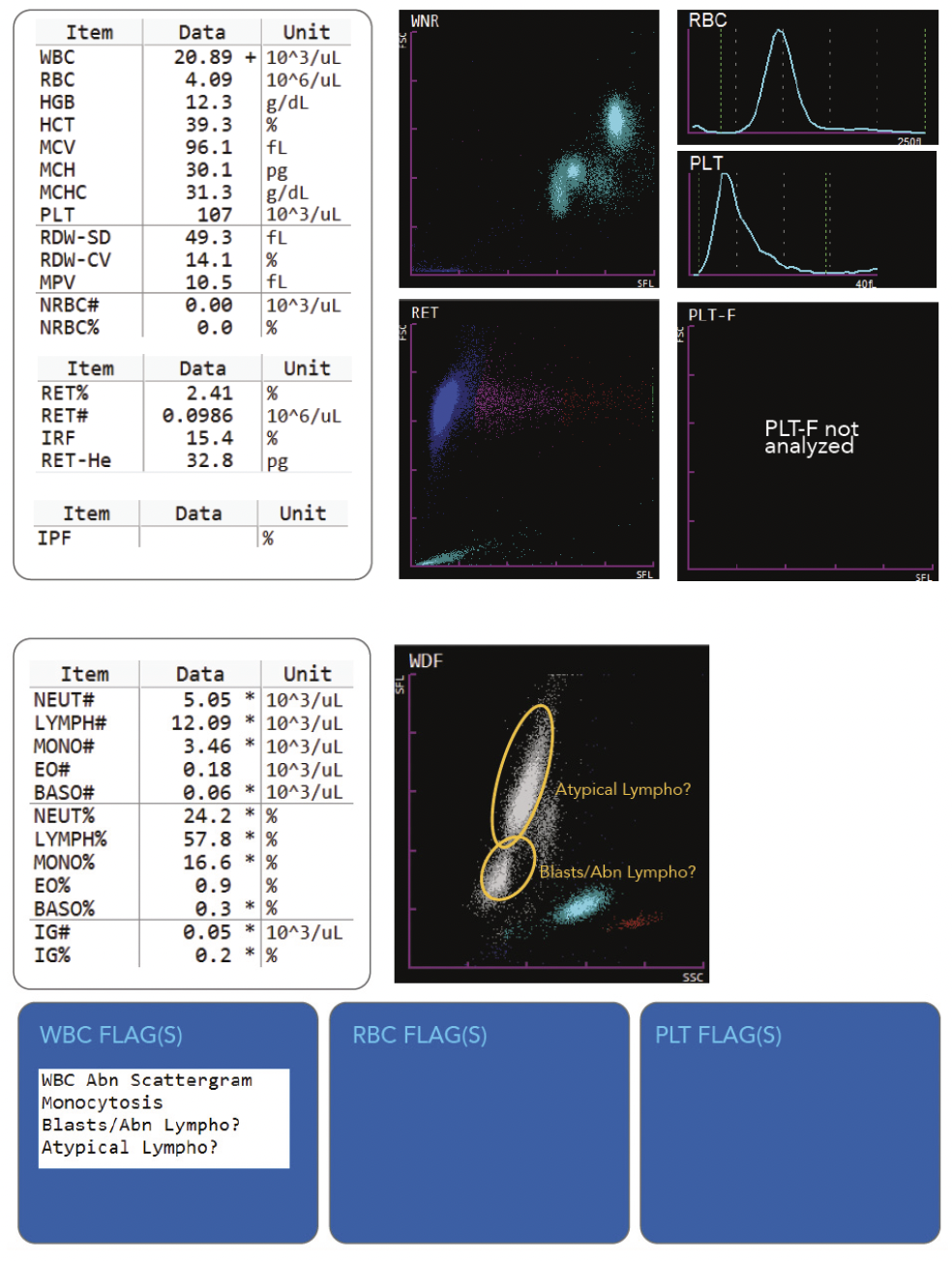 Hematology- Atypical Lympho- Image #1