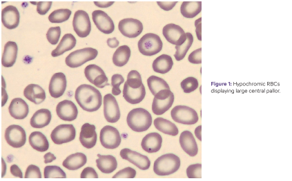 Hematology- Overview Anemia- Image #1