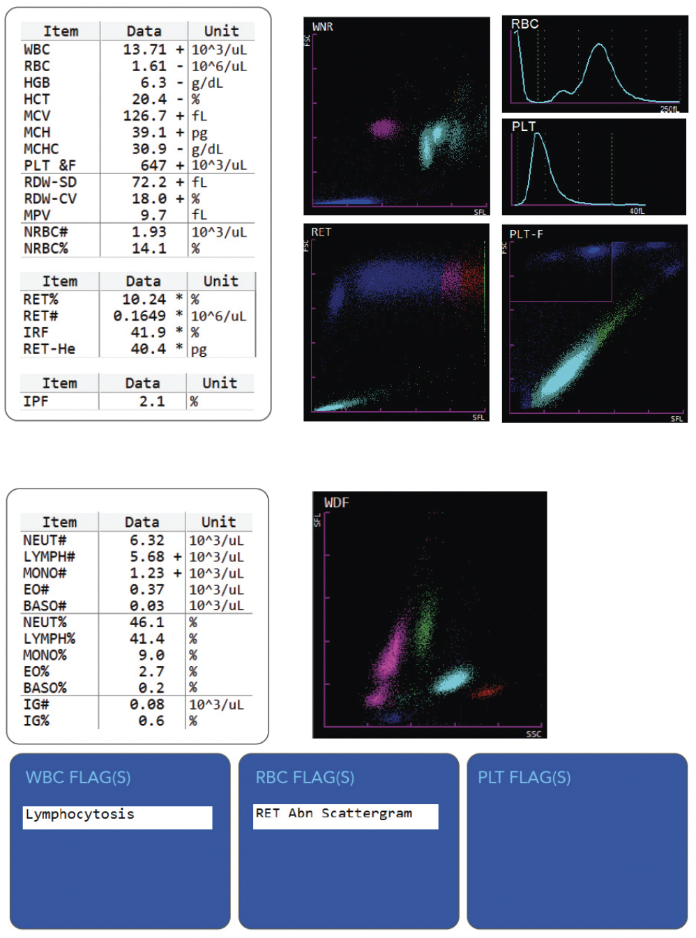 Hematology- Pyruvate Kinase Deficiency- Image #1