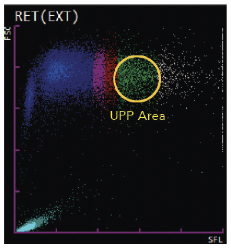 Hematology- Pyruvate Kinase Deficiency- Image #2
