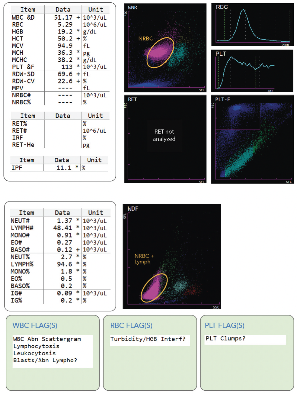 Hematology-WBC ABN Scattergram with NRBC- Image #1