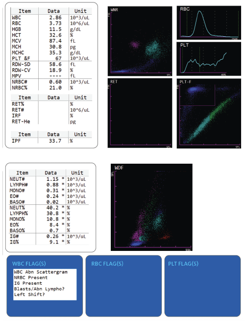 Hematology Case Study - Micromegakaryocytes Image #1