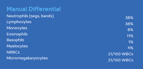 Hematology Case Study - Micromegakaryocytes Image #2