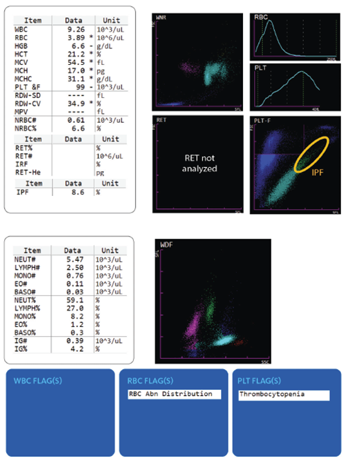 Hematology Case Study- Thalassemia Image #1