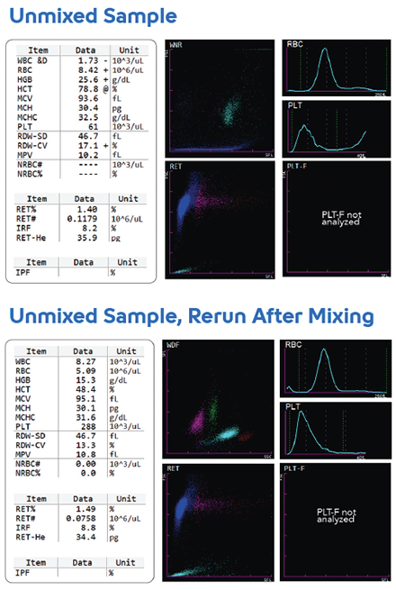 Hematology Case Study - Unmixed Sample Image #1
