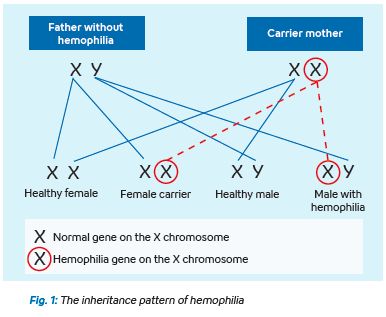 Hemostasis - What is Hemophelia-Image 1
