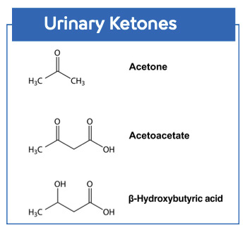 The Science of Ketonuria