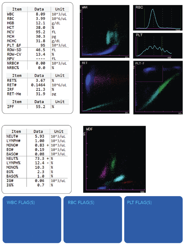 Sysmex Hematology Elevated IPF Scattergram Results 