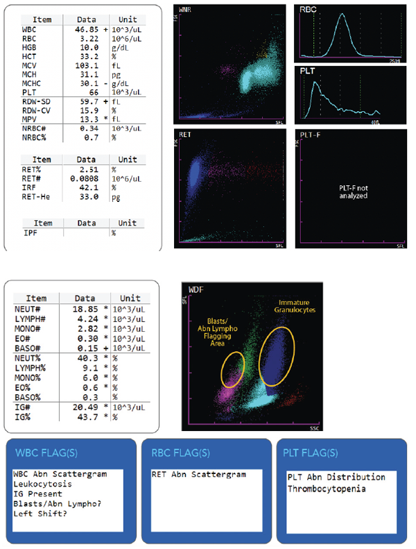 Hematology Immature Granulocytes Scattergram Results and Flags 