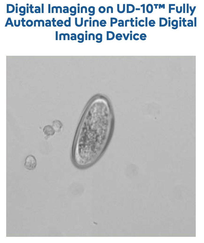 Urinalysis - Pinworm- Image-1