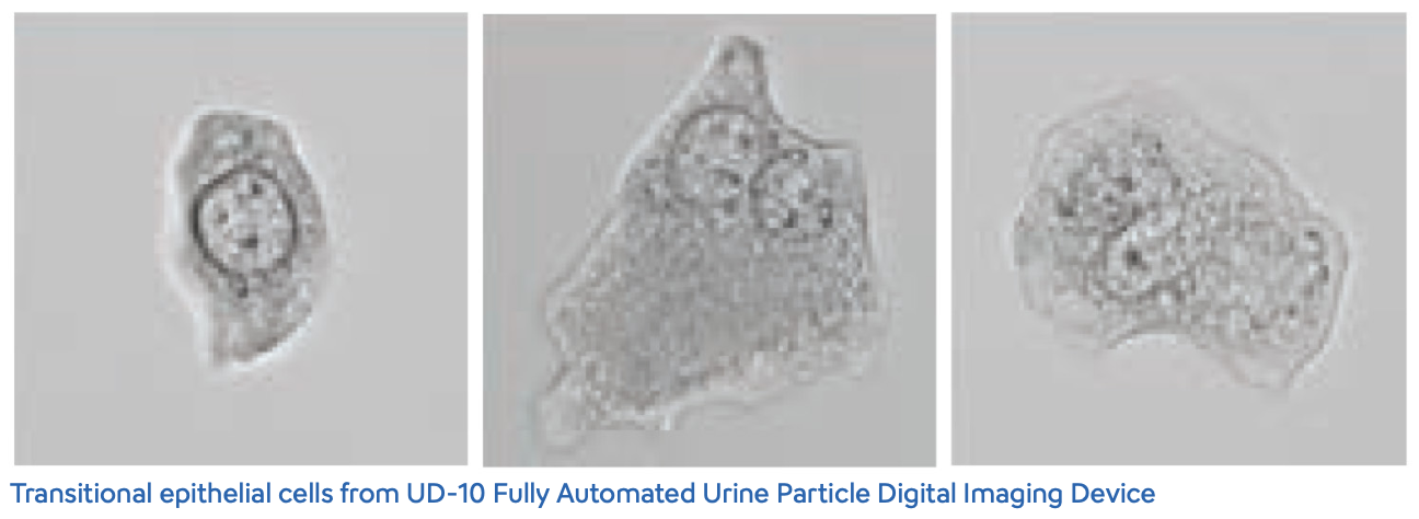 Urinalysis - Urothelial Cells- Image-1