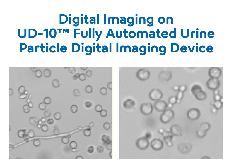 Urinalysis - What is Candiduria - Image-1