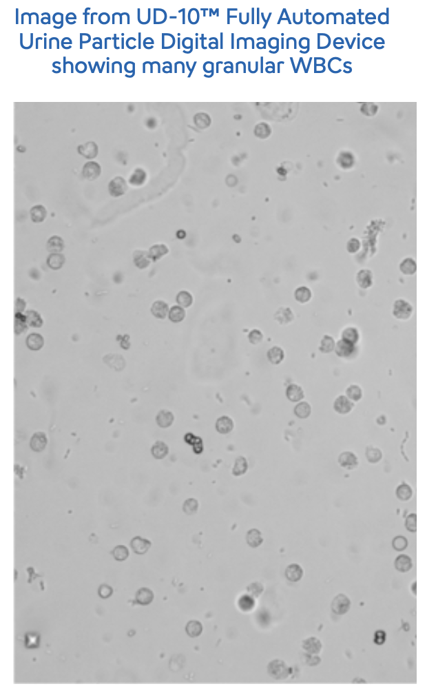 Urinalysis -Eosinophiluria- Image-1