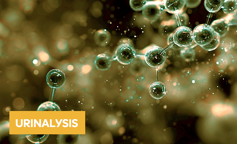 Urinalysis-Science-of-Sysmex urinalysis image