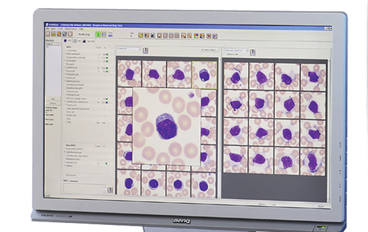 cell images on a monitor