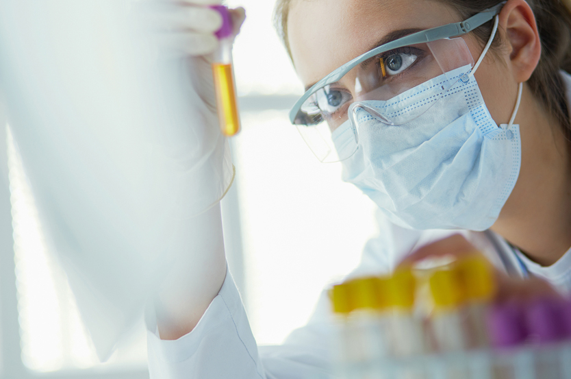 Urine image